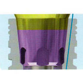 Структура дентальных имплантатов MIS - стоматологическая клиника СитиДентаМед