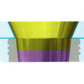 Структура дентальных имплантатов MIS - стоматологическая клиника СитиДентаМед